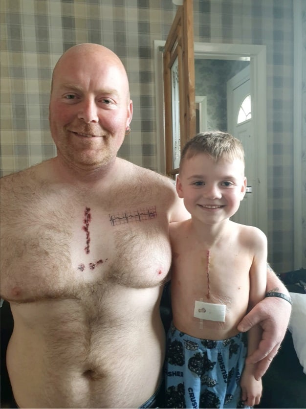  Por cicatriz do filho após cirurgia do coração, pai faz tatuagem igual para levantar autoestima